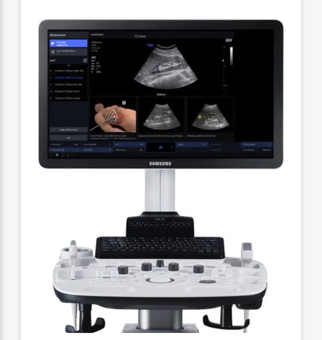 Échographie avec trois sondes spécialisées